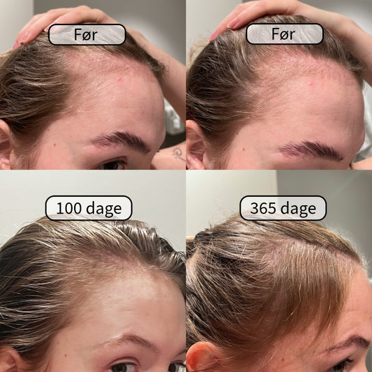 Gainer-Plex Hårserum™